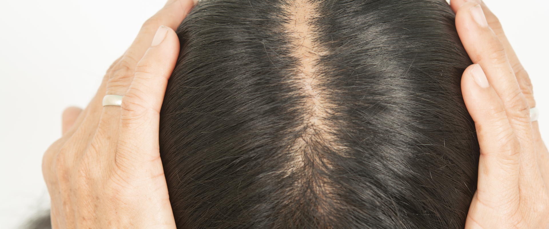 How to combat dry, thinning hair